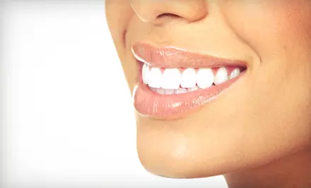 One 60-Minute Deluxe Teeth-Whitening Session or One Year of Teeth Whitening at UltraWhite Clinic (Up to 55% Off) - Primary Image