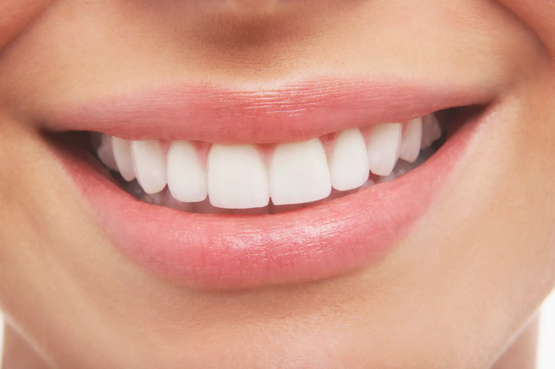 $49 for $1,000 Credit Toward Invisalign, Plus Exam and Whitening Kit at Weber Orthodontics ($1,150 Value)  - Primary Image