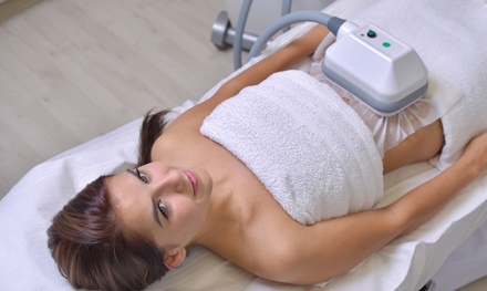 1 séance de cryolipolyse sur 1 zone d'1h05 (bras ou ventre ou ventre haut de l'abdomen)