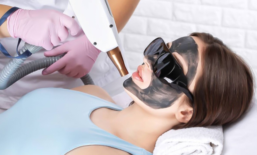 Image 8: Hollywood peeling con mascarilla de carbón activo y láser