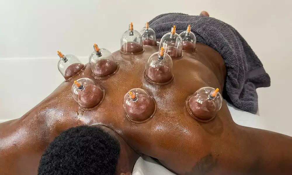 Targeted Relief: One 30-Minutes Acupuncture and / or Cupping Session