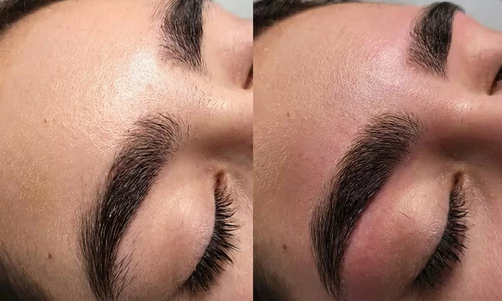 Smooth Skin with One or Three Full Brazilian and Underarm or Full Leg