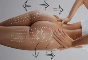 Einzel- oder 3er-Sitzung à 30 Min. Po-Lift durch Vakuum-Anwendung für 1 Person (bis zu 66% sparen)