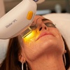 Image 1: Lumenis M22 IPL Photofacial for Clear, Radiant Skin
