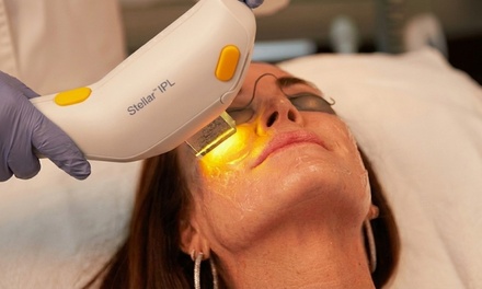 One Lumenis Stellar M22 IPL/Photofacial Treatment for Face - W&M Beauty Center