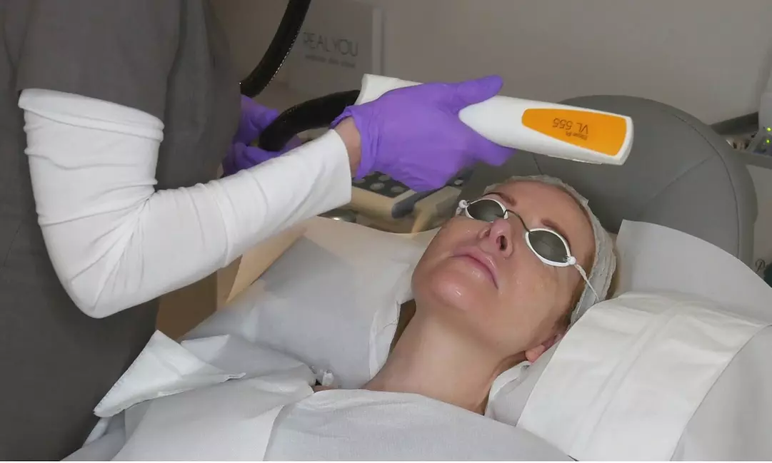 Get 1, 2, or 3 Nordlys Photo Rejuvenation/ IPL Treatment for the Face