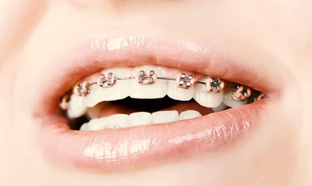 Tratamiento de ortodoncia con brackets metálicos convencionales para 1 persona - CLÍNICA DENTAL DÍAZ LÓPEZ