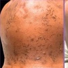 Image 2: Get Smooth Skin with Laser Hair Removal Treatments
