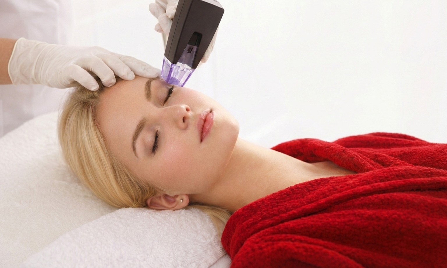 Morpheus 8: El lifting sin cirugía con radiofrecuencia fraccionada