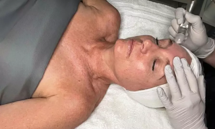 Express Microdermabrasion & Mask w/w/o Extractions + Enzyme Treatment