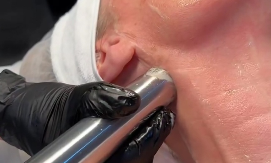 Image 4: Refresh Your Skin with One or Two 75-Minute Rejuvenation Treatments