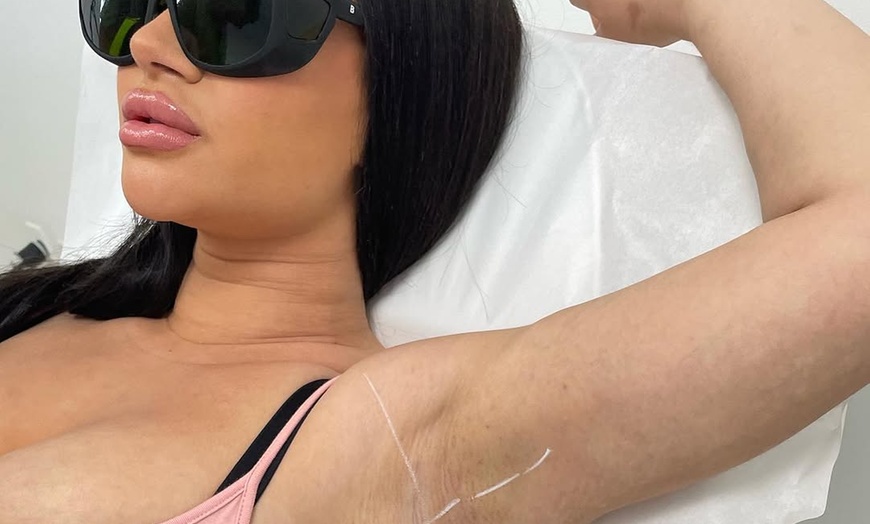 Image 7: Unlimited Laser Hair Removal for Extra-Small Area or 6 Sessions 