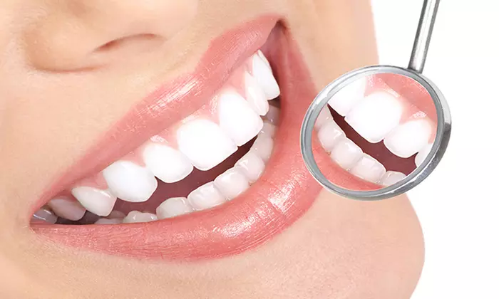 Visita, pulizia denti, sbiancamento LED e bite per una persona o prevenzione carie fino a 3 bambini - Primary Image