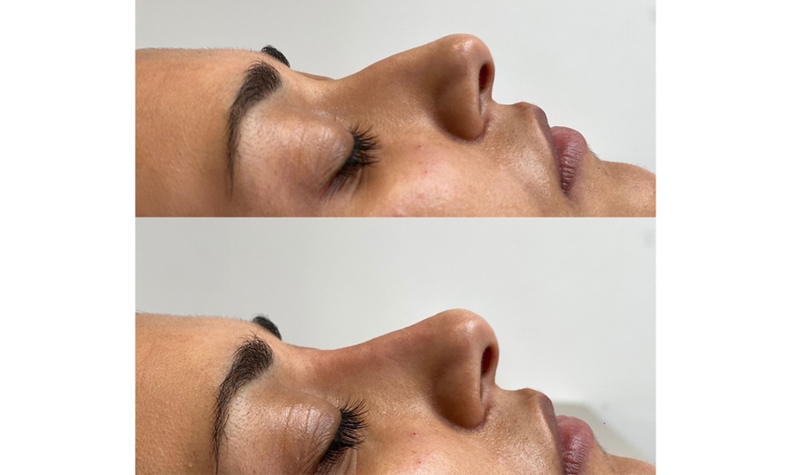 Image 4: Get Smooth Skin with 1, 2, or 3 Dark Circle / Under Eye Treatments