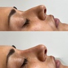 Image 4: Get Smooth Skin with 1, 2, or 3 Dark Circle / Under Eye Treatments