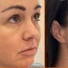 Image 1: Boost Your Glow with Natural PRF Treatments