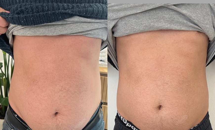 Image 4: Bis zu 42% Rabatt auf den EMS (elektrische Muskelstimulation) bei Esthétique de paris