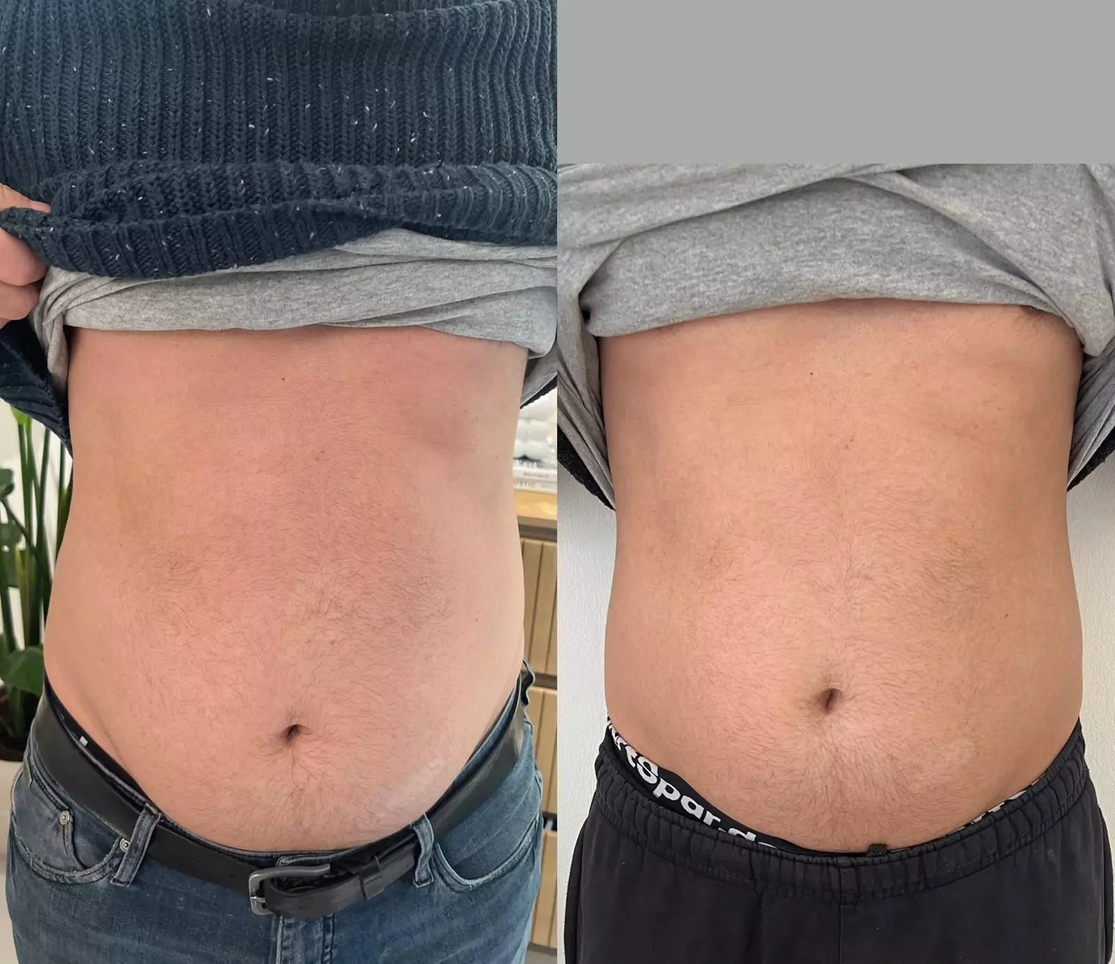 Bis zu 42% Rabatt auf den EMS (elektrische Muskelstimulation) bei Esthétique de paris