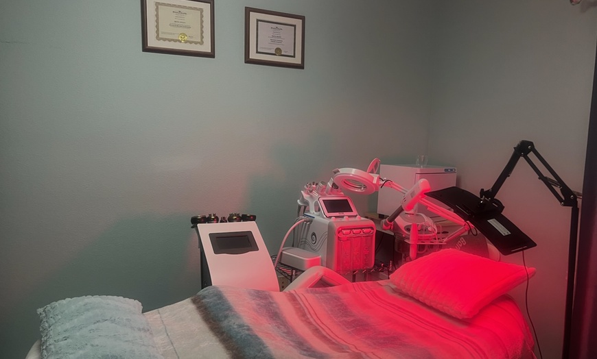 Image 2: Experience Renewed Skin with Microneedling Treatment Options