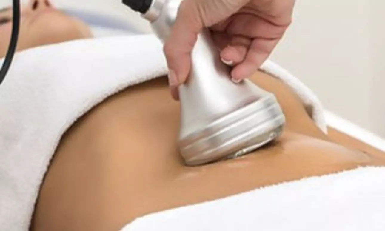 Lift, Tighten & Rejuvenate Your Skin Without Surgery with RF Skin Tightening at Rose Beauty Bar - Primary Image