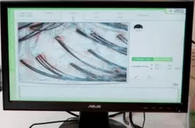 Haarausfallbehandlung + Diagnose