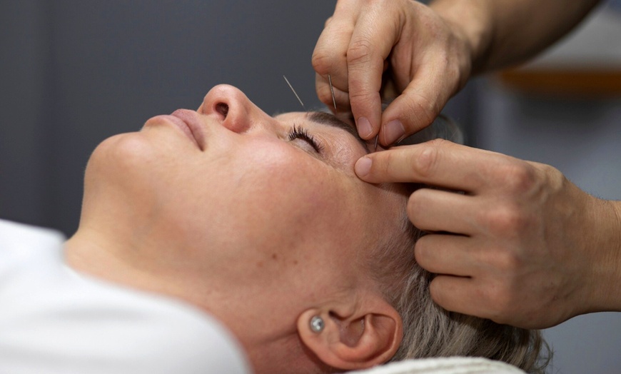 Image 2: Up to 45% Off on Facelift - Non-Surgical at Violet Wellness Spa by Tian Chao Herbs and Acupuncture