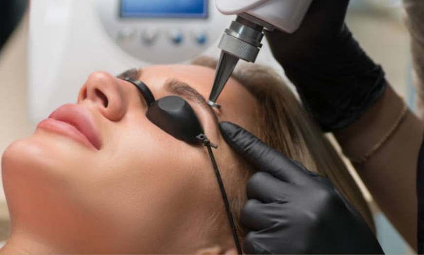 Image 5: 5 o 10 sesiones de eliminación de tatuajes