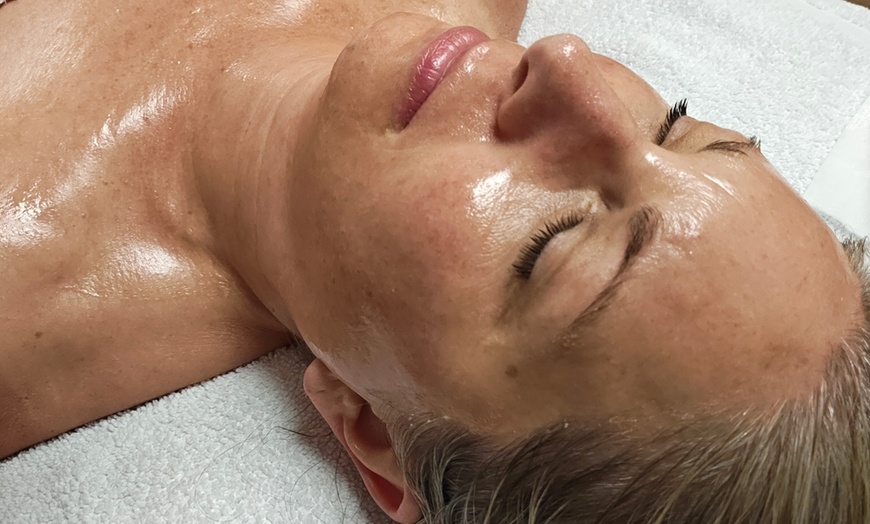 Image 5: Microdermabrasion or Microchanneling Facial for Rejuvenated Skin
