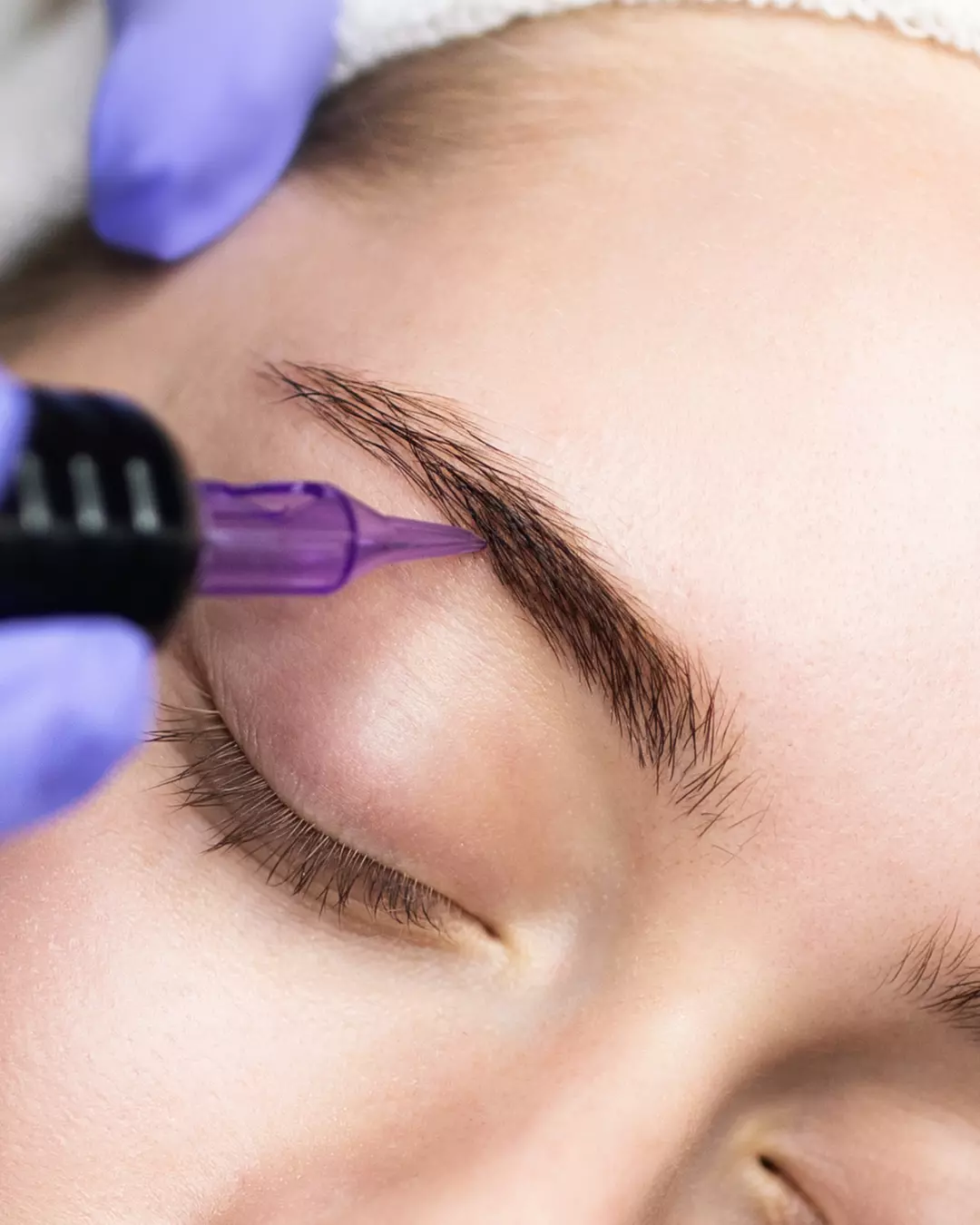 Brow Tattoo Removal