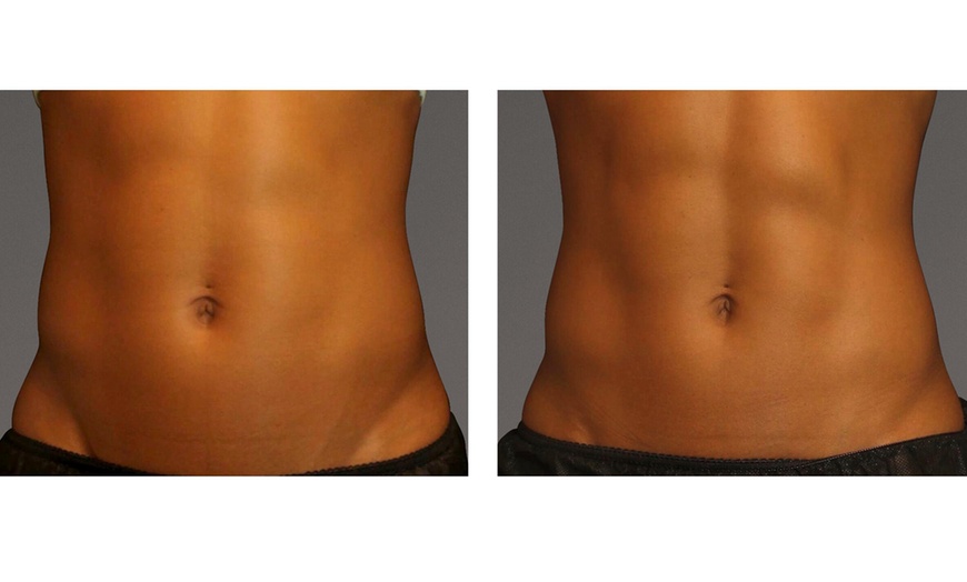 Image 2: One or Two Cool Tone Sessions for Body Toning
