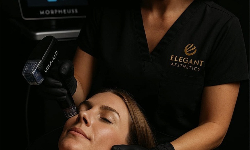 Image 2: Defy Aging: Rediscover Youth with Our PRP & Morpheus8 Packages 