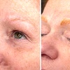 Image 4: Get One or Two Microblading Sessions and Complimentary 5 Week Touch Up