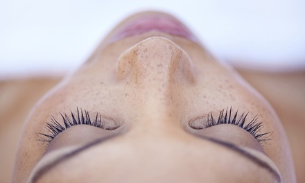 1x Epionce Physician Strength Chemical Peel (SAL-E & MAL-E) + Consultation (30-Min) - Arch Aesthetics