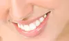 Dental Hygiene Checkup with Cleaning, Fluoride, and Optional Whitening at Unique Dental Hygiene Care (Up to 73% Off)