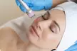 Hasta 4 sesiones de radiofrecuencia en cara y cuello de 30-40 min. para 1 persona; ahorra hasta un 58% - Image 2