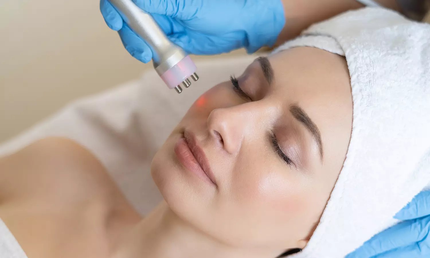 Hasta 4 sesiones de radiofrecuencia en cara y cuello para 1 persona