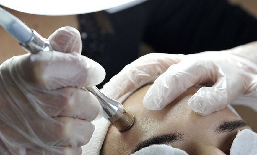 Image 11: Revitalize Your Summer Glow with Luxury Microdermabrasion Facial