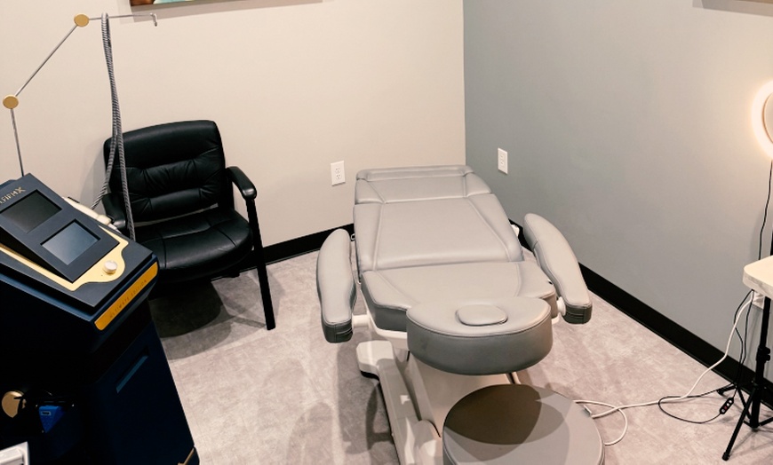 Image 2: Radiofrequency Microneedling Treatment for Face w/w/o Neck and Chest 