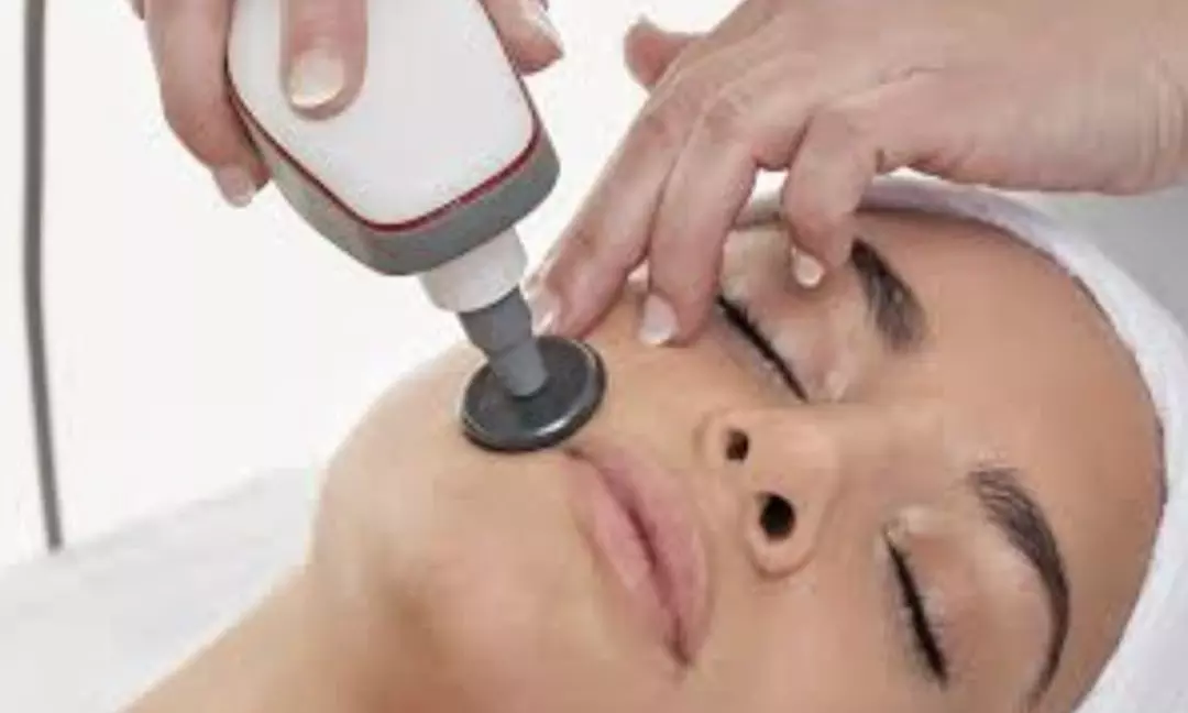 Limpieza facial con punta de diamante, 1 o 3 sesiones