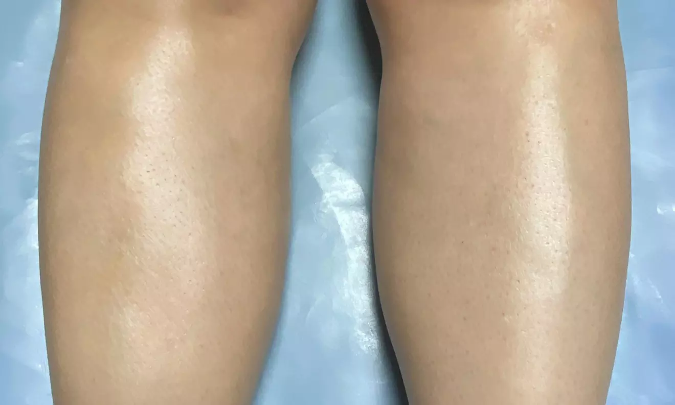 Underarm and Lower Leg Wax or Full Legs, Bikini, and Underarms Wax