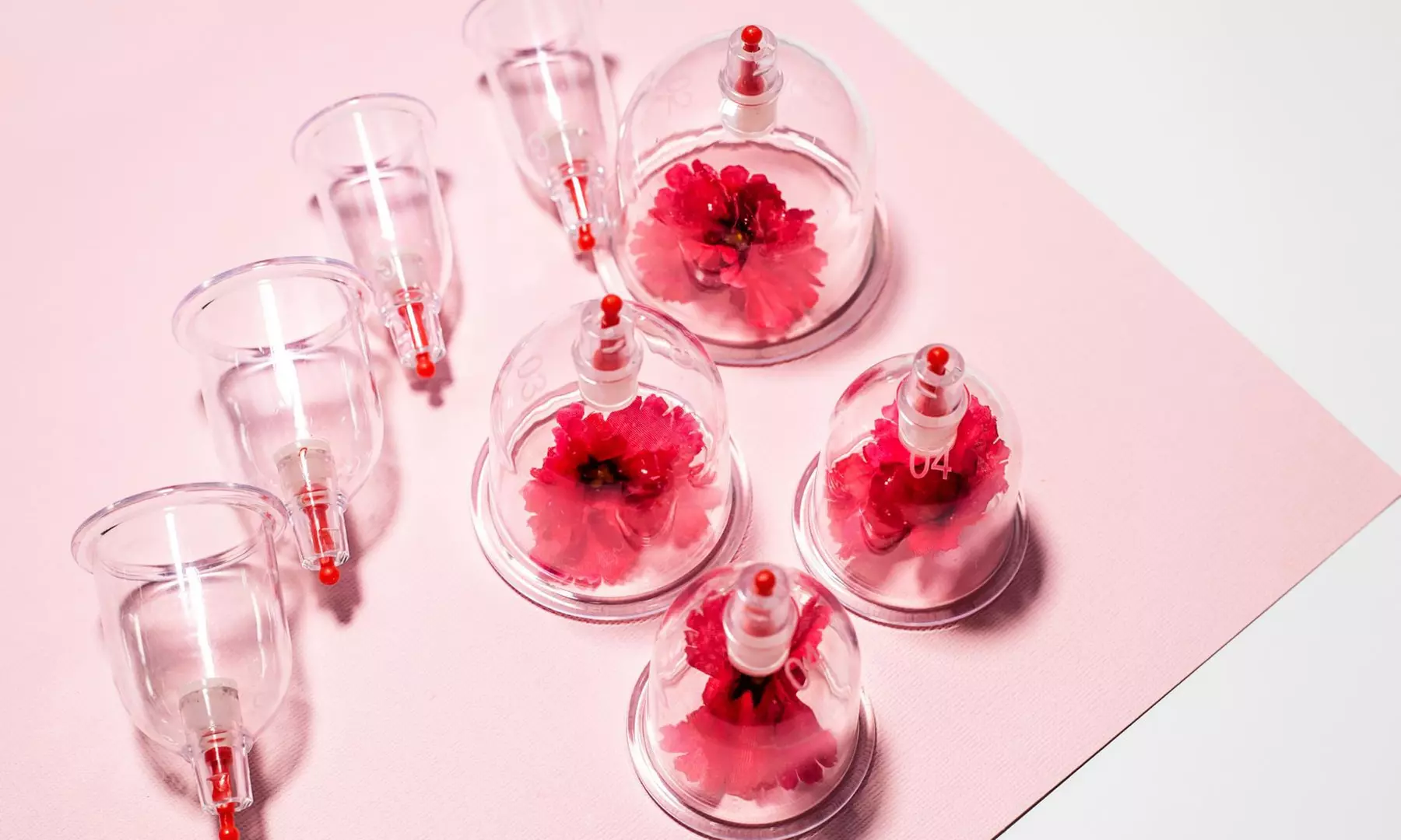 Acupuncture Cupping Scraping Hot-towel compression, Massage or More