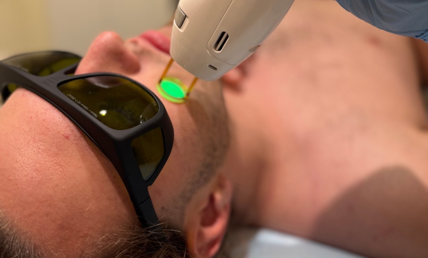 Image 4: 6 Laser Hair Removal Sessions One Small, Medium, or Large Area