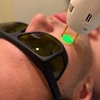 Image 4: 6 Laser Hair Removal Sessions One Small, Medium, or Large Area