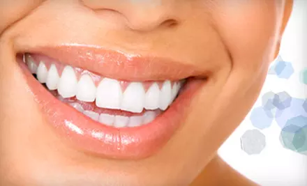 $79 for One-Hour, In-Office, Teeth-Whitening Treatment with Take-Home Whitening Pen from Smile Splendor ($324.90 Value) - Primary Image