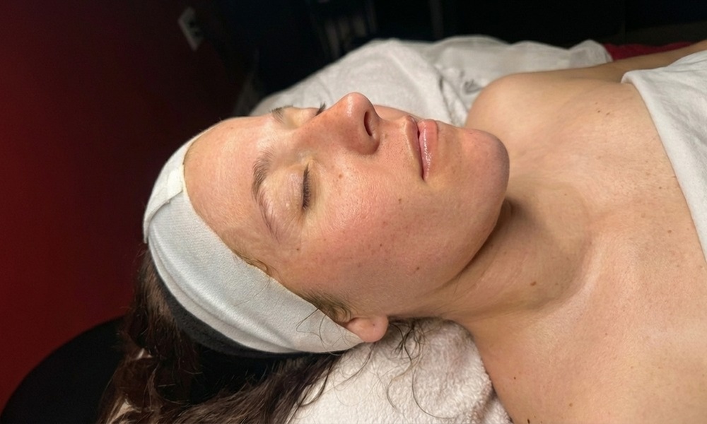 Rejuvenate Skin with Professional Chemical Peels for a Healthy Glow