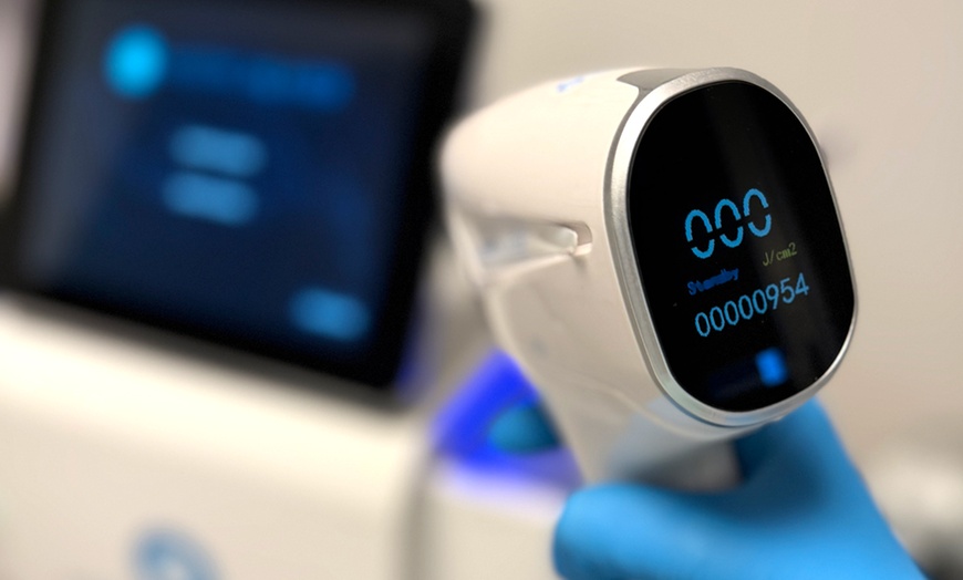 Image 2: L’épilation laser sans prise de tête avec Beauté Oks