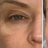 Image 1: Non-Surgical Facelift Options