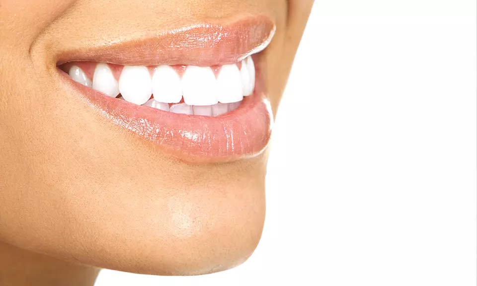 One or Two Porcelain Veneers at Brian Dental Care (Up to 53% Off) - Primary Image