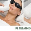 Image 2: IPL Photofacial Treatments for Pigmentation and Redness