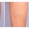 Image 4: 6 Sessions of Laser Hair Removal in Small, Medium, Large Areas & More